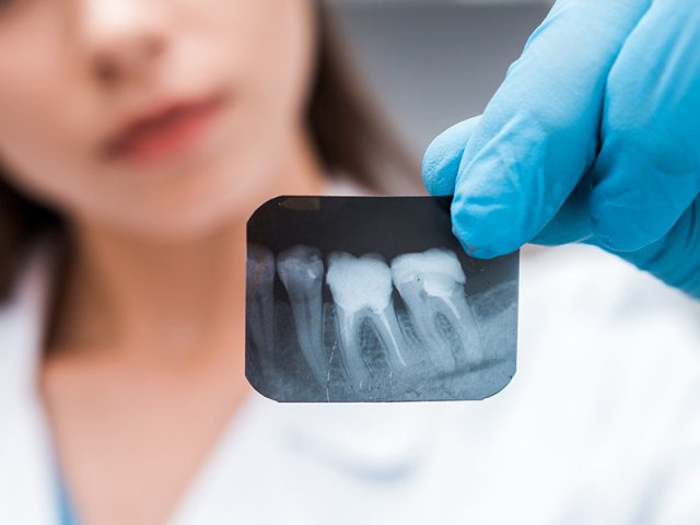 Exams & X-rays https://thedentalbartt.com/quoviz_storage/2024/12/Exams-X-rays-640x480.jpg
