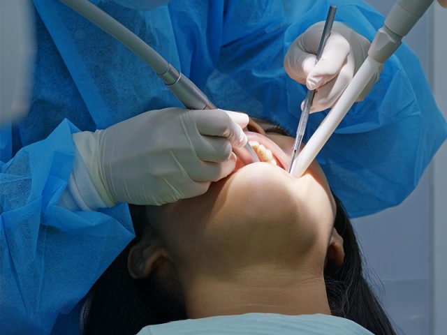Oral Surgery https://thedentalbartt.com/quoviz_storage/2024/12/Oral-Surgery-640x480.jpg